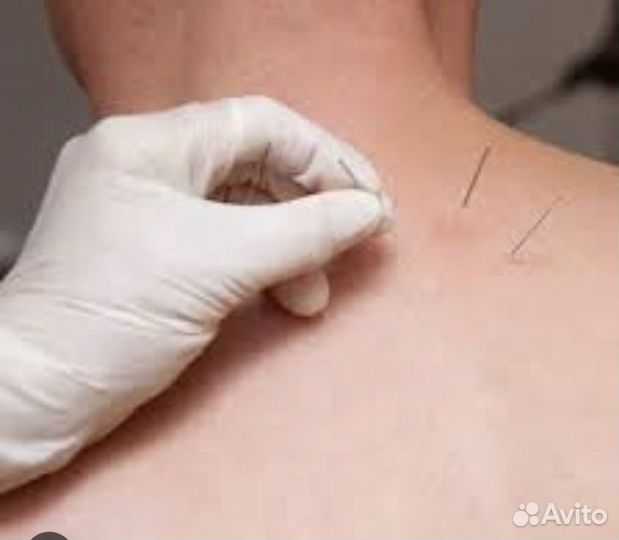 Косметология лица