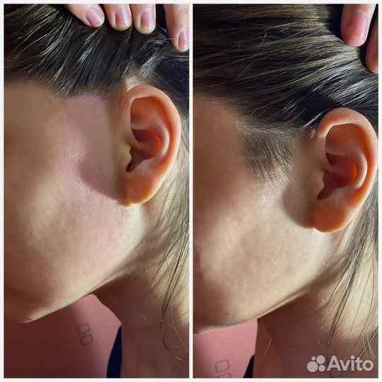 Восковая Эпиляция Шугаринг