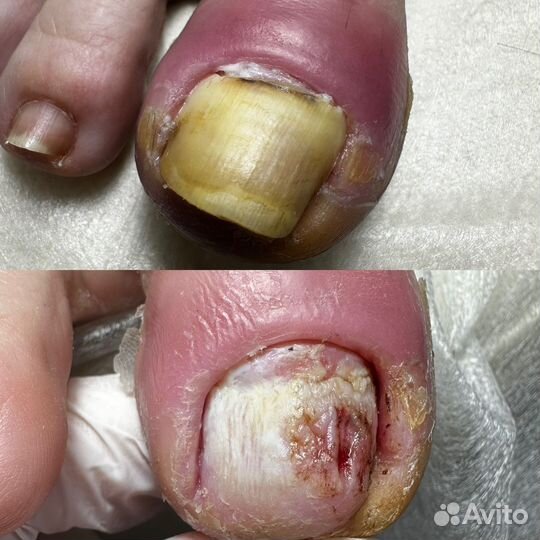 Подолог мастер педикюра