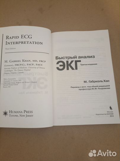 Быстрый анализ экг