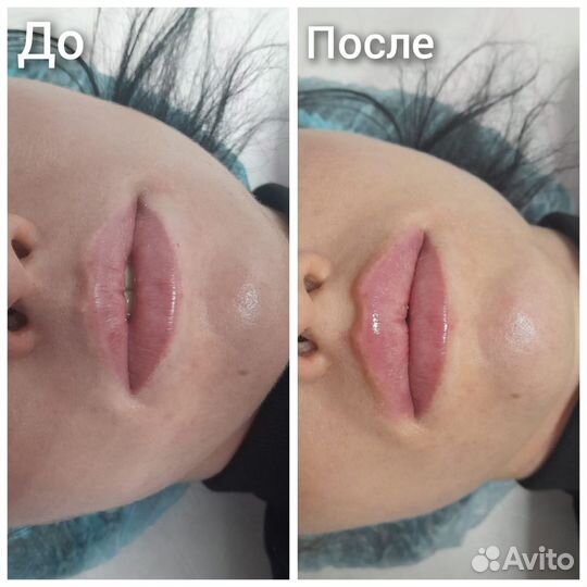 Наращивание ресниц. Косметология