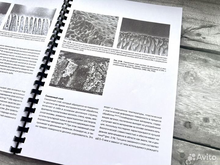 Внутрикорневые реставрации