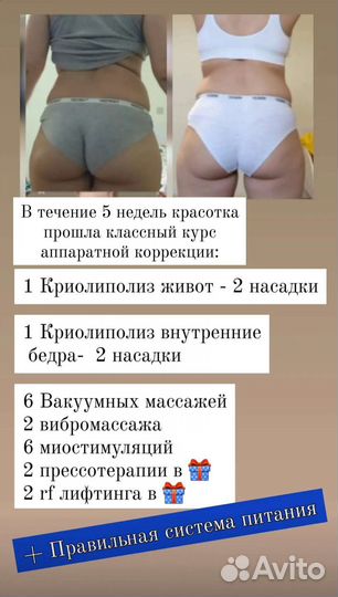 Криолиполиз на новейшем аппарате. Прессотерапия