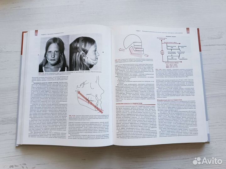 Современная ортодонтия Уильям Р. Проффит учебник