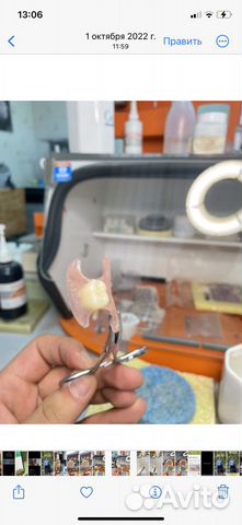 Зубные протезы