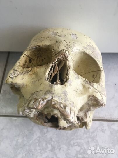 Довоенный медицинский череп