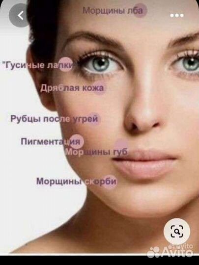 Аппаратный массаж:кавитация, рф-лифтинг липолиз