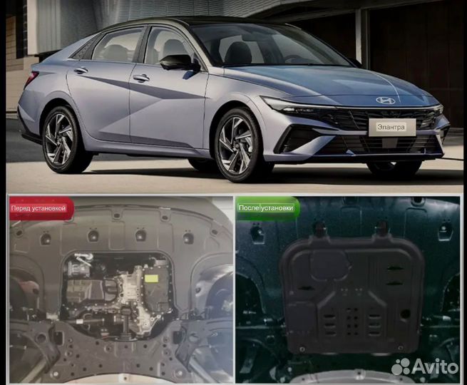 Защита двигателя Hyundai Elantra 2023