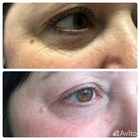 Холодная плазма/обучение