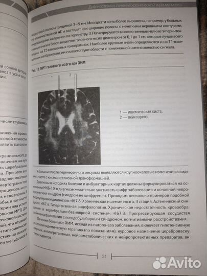 Неврология лекции