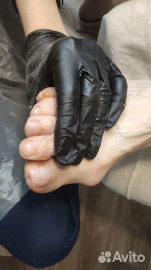 Подолог со стажем. Любые проблемы ног и рук