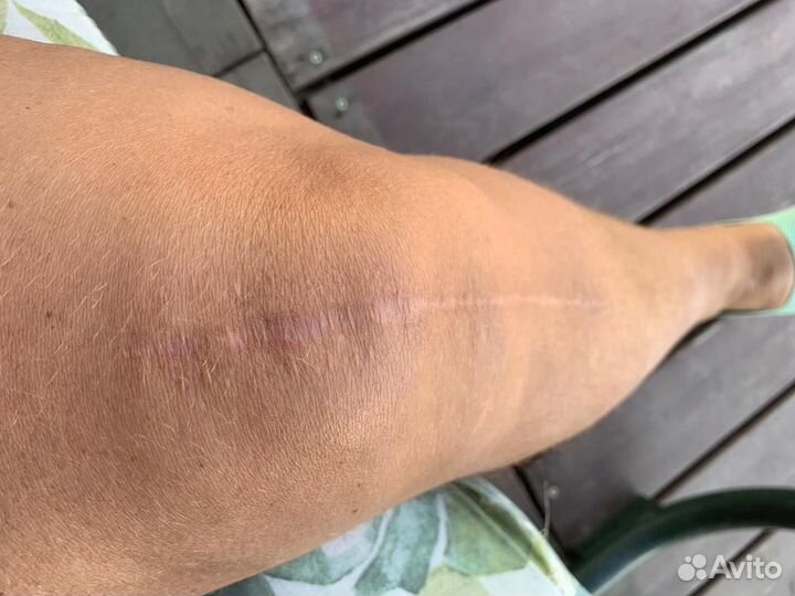 Крем для рассасывания послеоперационных швов