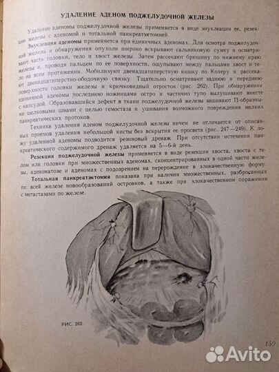 Атлас хирургических операций А.А.Шалимов