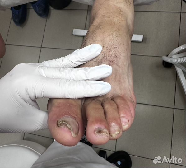 Услуги подолога