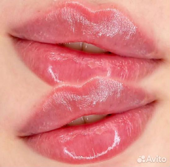 Биоревитализация