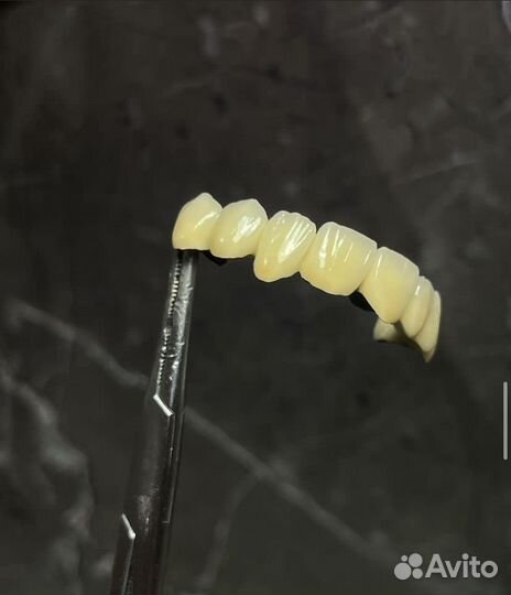 Зубные протезы