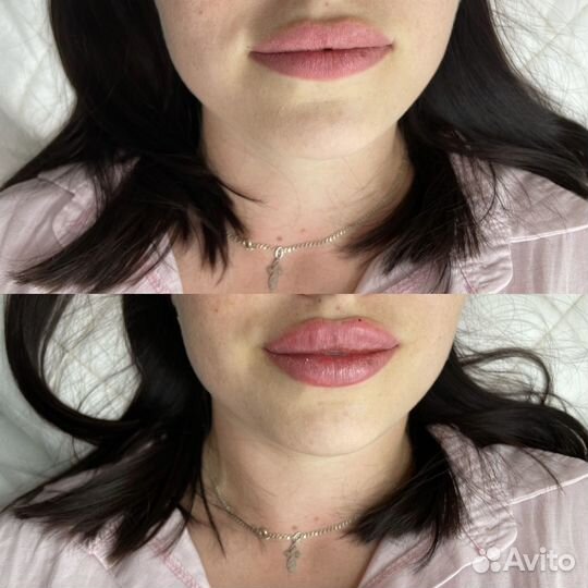 Обучение косметологов