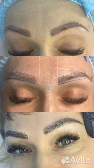 Микроблейдинг