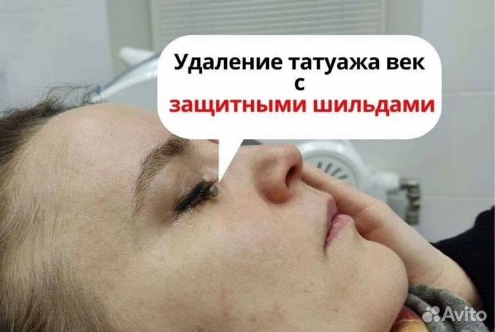 Аппарат для удаления татуировок и татуажа