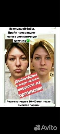 Драйнэффект NL от отёков для похудения