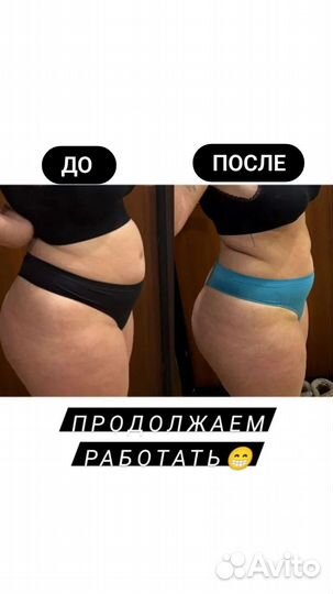 Массаж антицеллюлитный