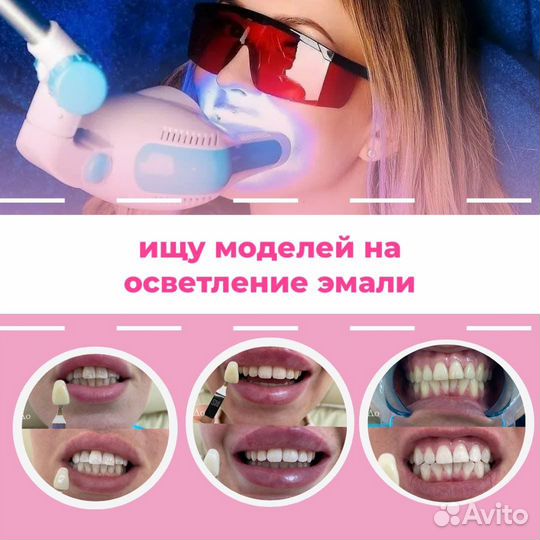 Модели на скайсы и осветление эмали