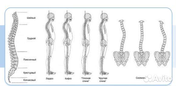 Йога на воздухе в парке