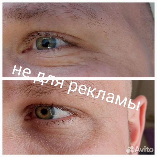 Холодная плазма хис