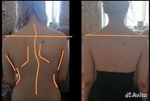 Лечебный массаж, Кедровая Фитобочка для женщин объявление продам