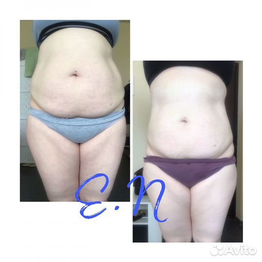 Коррекция фигуры