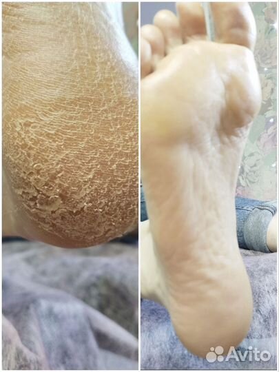 Педикюр