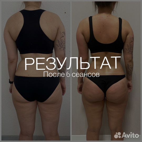 Коррекция фигуры/вакуумный массаж