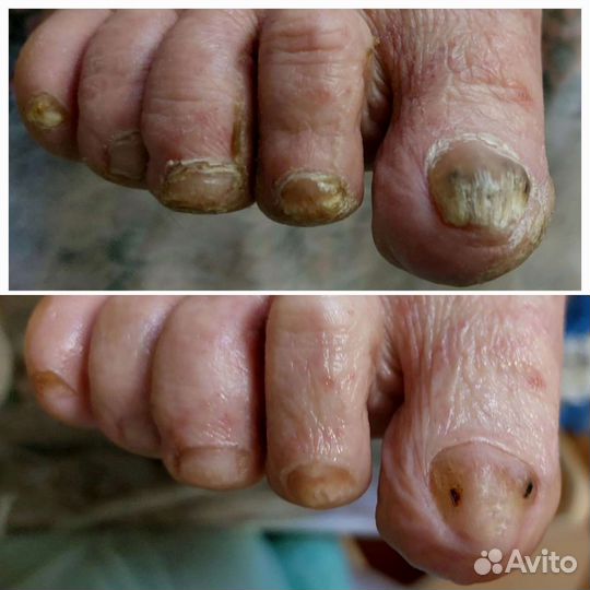 Подолог.Выезд на дом