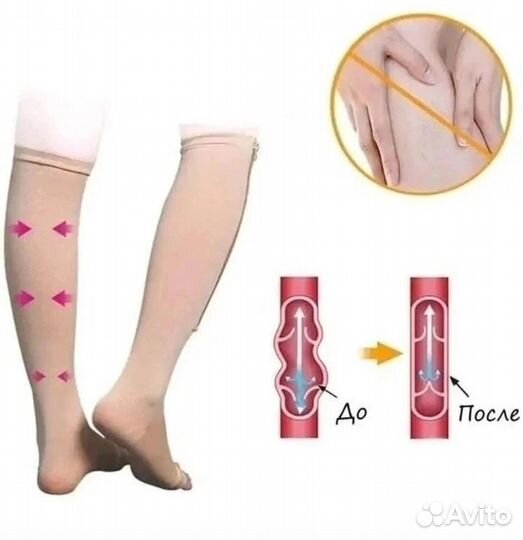 Компрессионные гольфы Zip Sox