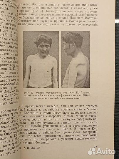 Клещевой энцефаломиелит. Шаповал. 1980