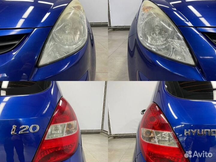 Hyundai i20, 2010