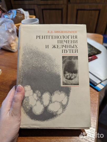 Рентгенология печени и желчных путей