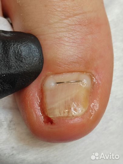 Услуги подолога