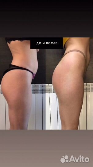 Массаж коррекция фигуры