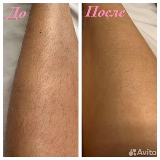 Шугаринг/ Восковая депиляция