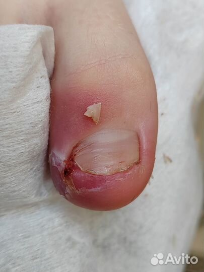 Услуги подолога