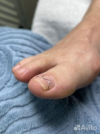 Услуги подолога