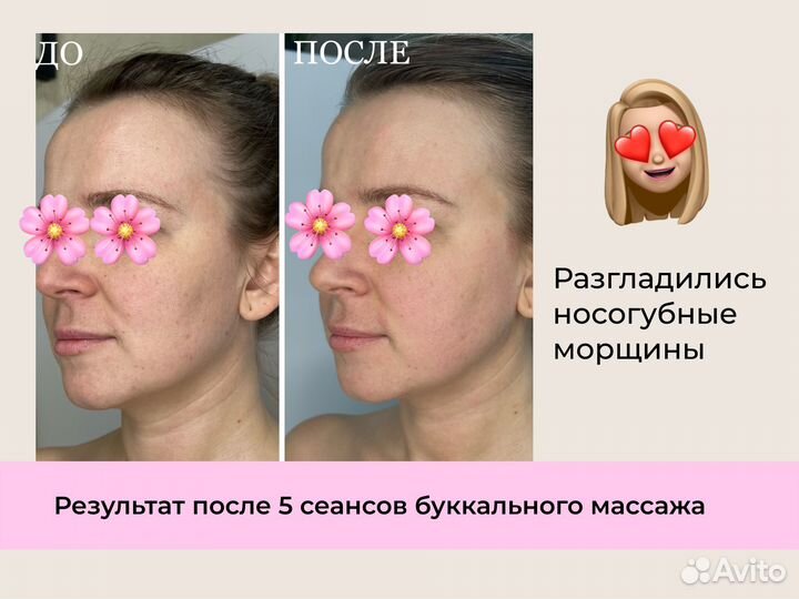 Массаж на дому