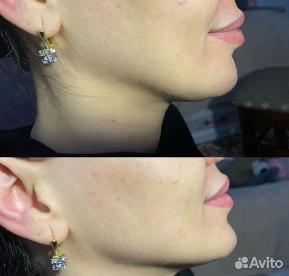 Услуги косметолога full face