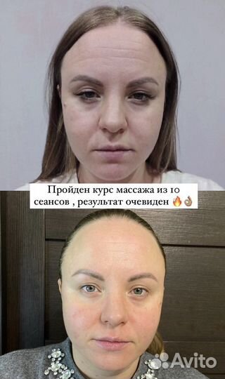 Массаж лица и тела face.embrace.spb