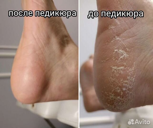 Маникюр и педикюр