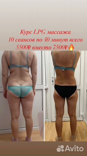 Требуются модели по коррекции фигуры и похудению