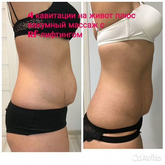 Лимфодренажный массаж