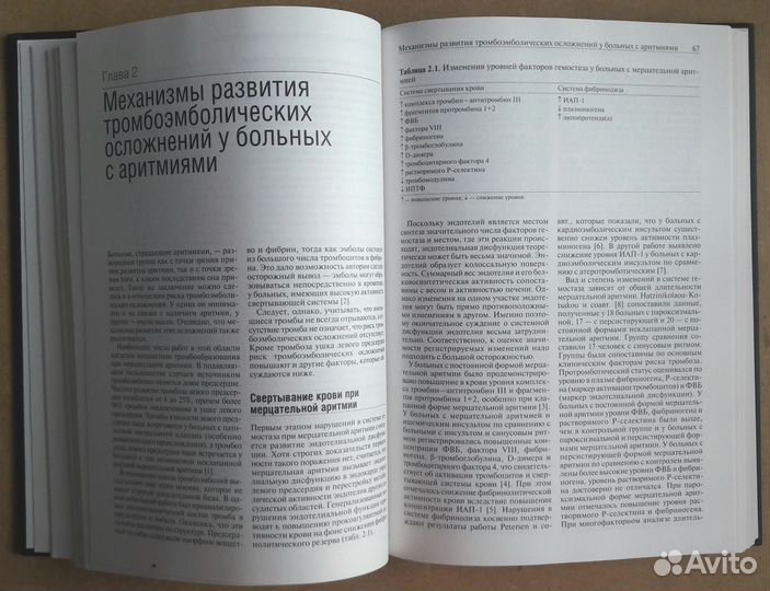 Тромбозы и Антитром-я Терапия при аритмиях