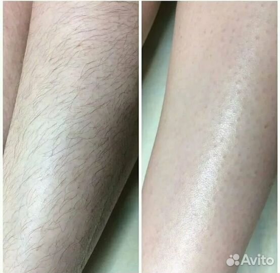 Массажистка,шугаринг